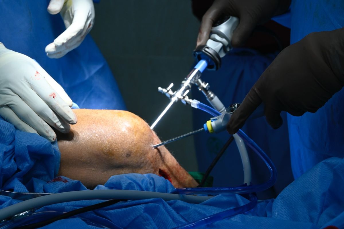 Keyhole orthopaedic surgery in progress