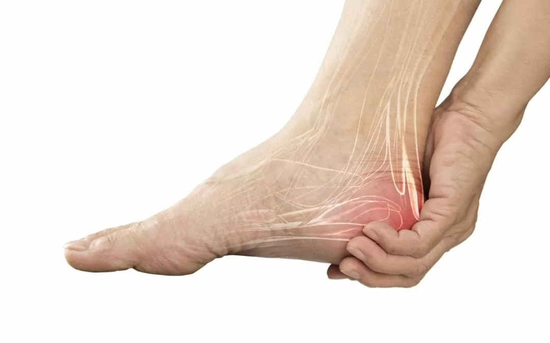 Foot with pain highlighted at the Achilles tendon and heel